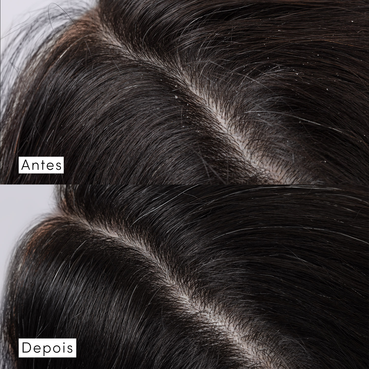 Shampoo Siàge Dermo Hair Scalp Rebalance 300ml