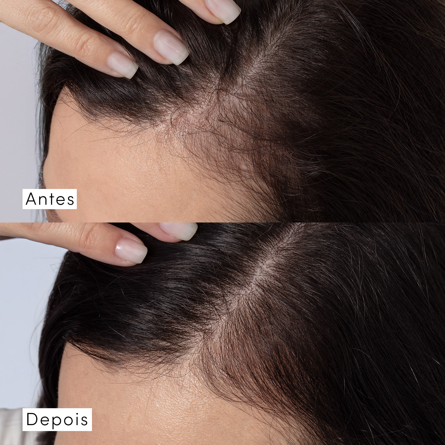 Tônico Concentrado Siàge Dermo Hair Resistência Antiqueda 100ml