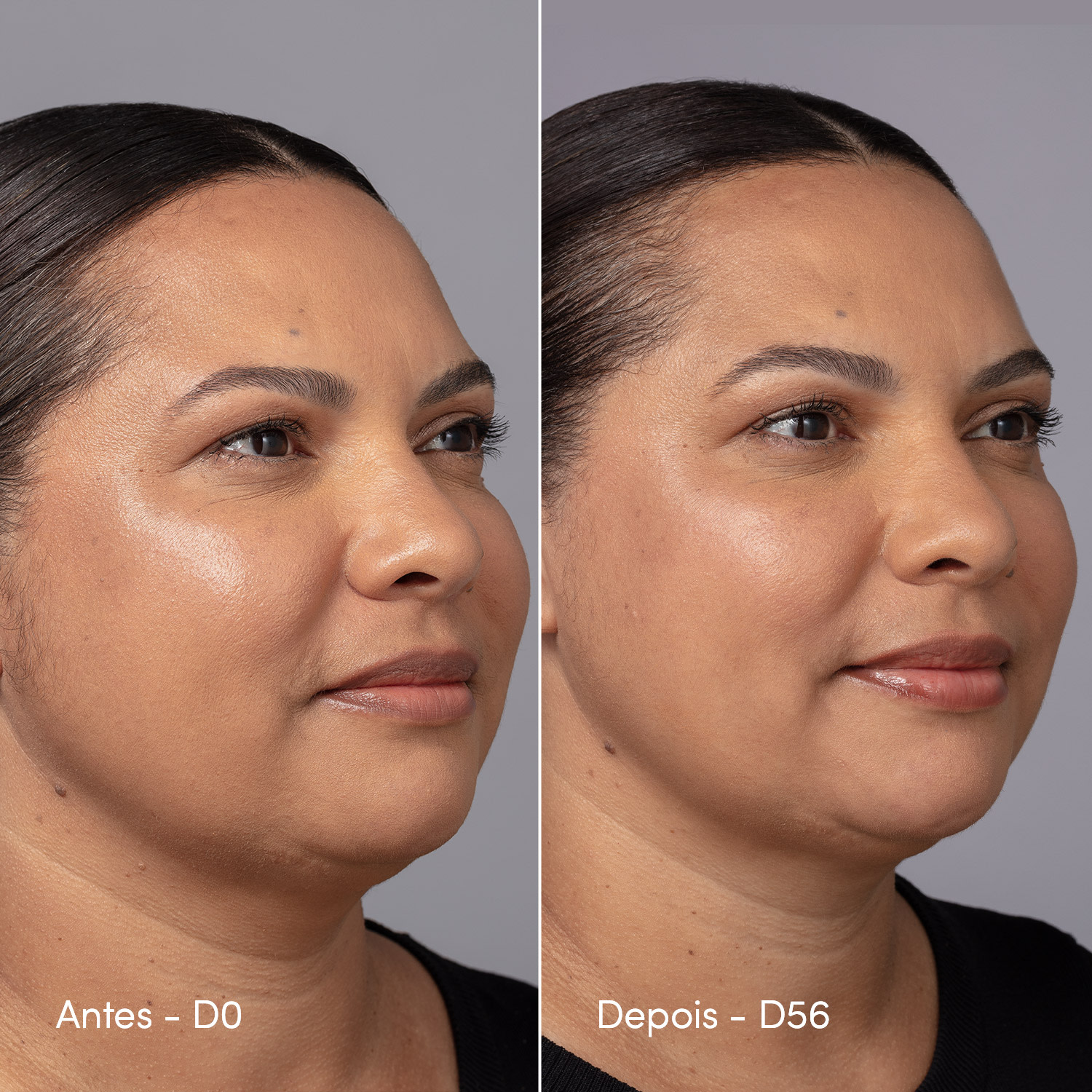 Creme de Contorno Facial Active Pro Bio Colágeno Neo Dermo 50g